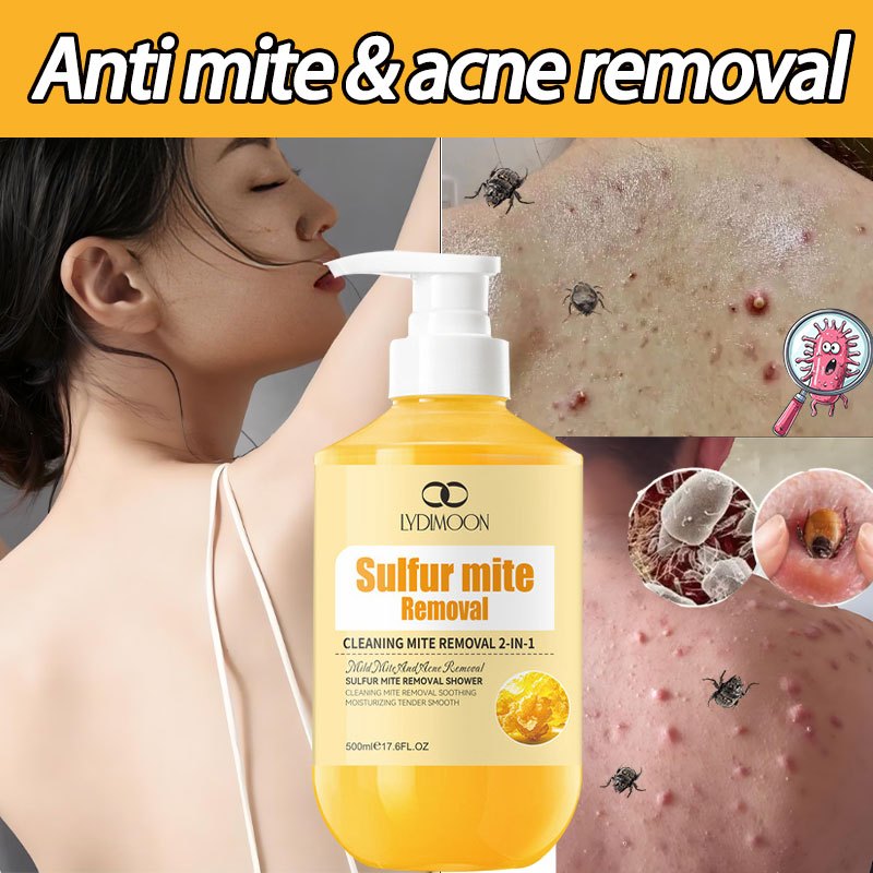 Image showcasing LYDIMOON Sulfur shower gel Dust mite Acne treatment Itchy skin relief ...