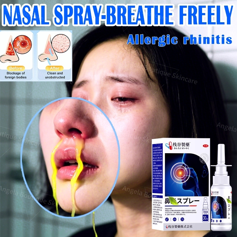 Nasal spray Rhinitis Nasal Congestion Toothache Spray Mouth Ulcers ...
