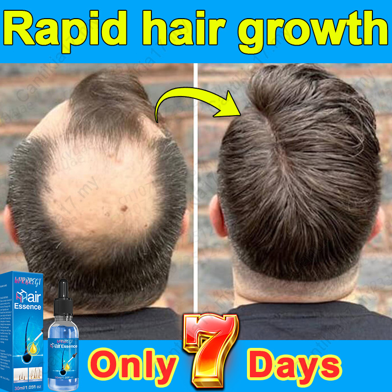 New hair growth in 7 days fast hair growth stimulant hair growth ...