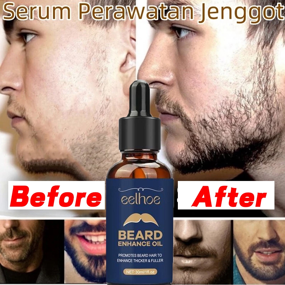 Eelhoe Men Beard Growth Oil Beard Care Oil Beard Growth Serum Tonic