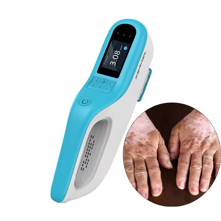Kernel KN-5000E high power 308nm Excimer Laser Phototherapy device for ...