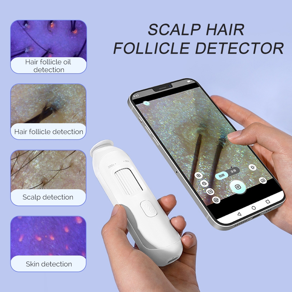 Foreverlily Multi-function Scalp hair follicle detector USB Digital ...