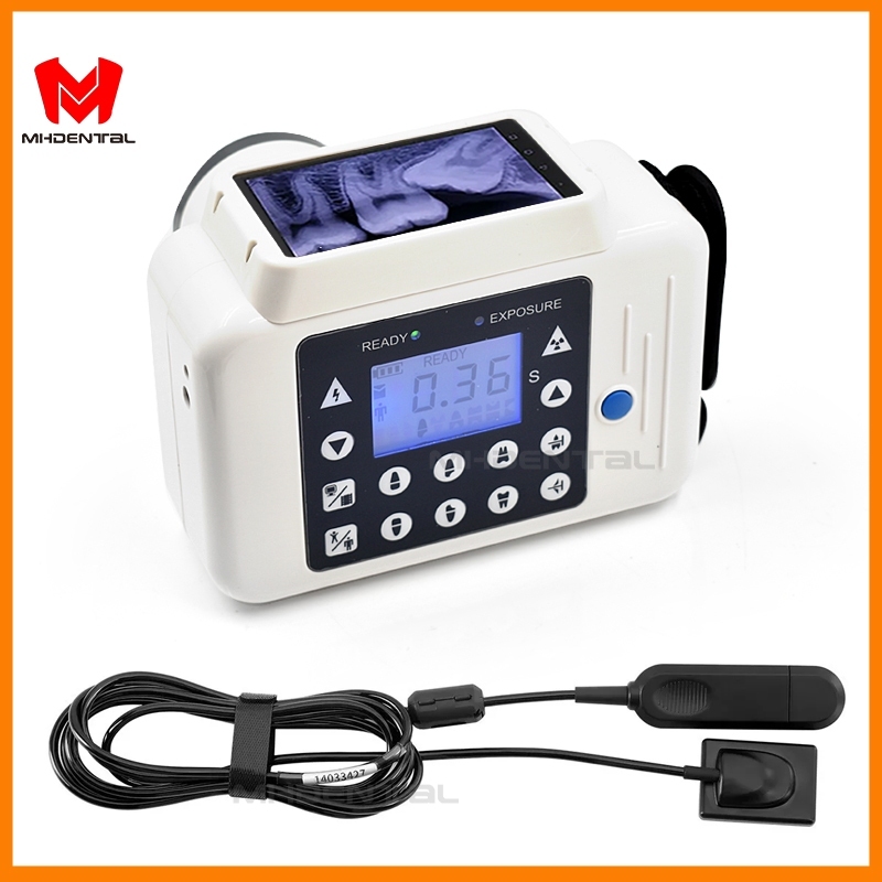 Dental Imaging System Portable Digital X-Ray Machine With Portable Rvg ...