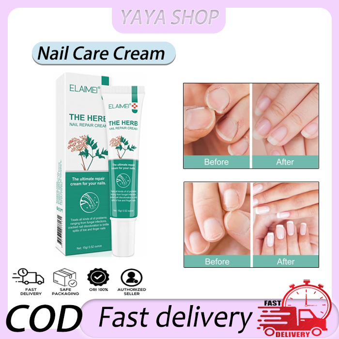 Elaimei Nail Care Cream anti-cracking fungal infection, treating ...