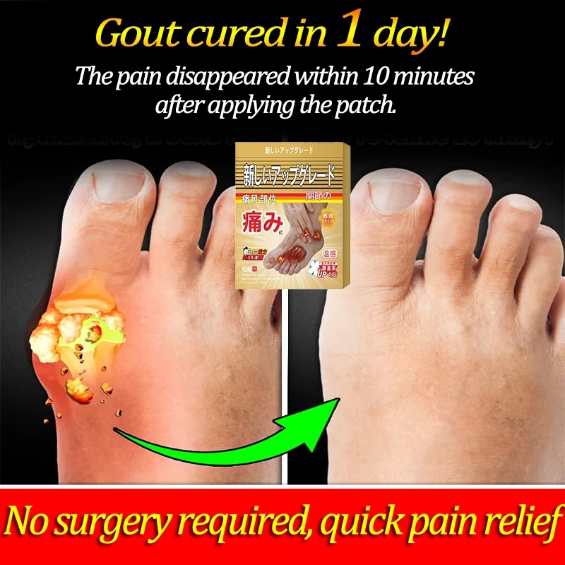 Mitsui Gout Patch Japan Gout Patch Pain Relief Patch Ubat gout Improve ...