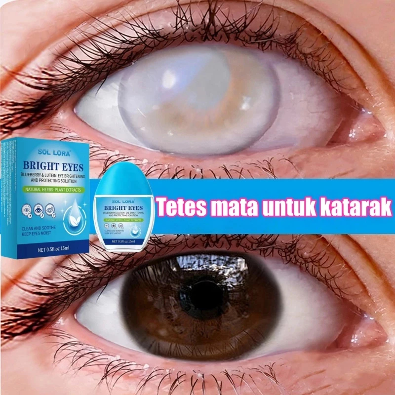 Obat Mata Katarak Obat Tetes Mata Alami Obat Mata Merah Eye Drop ...