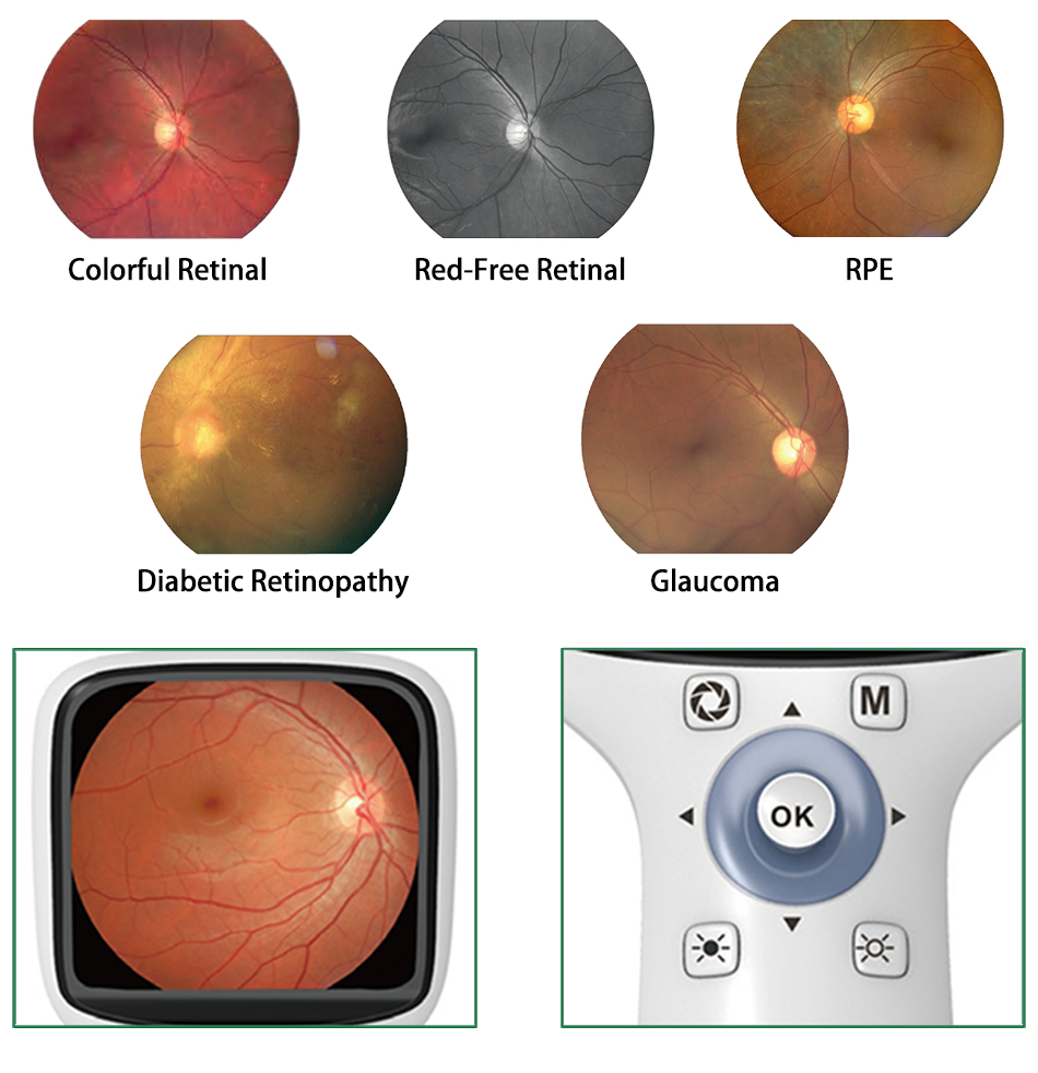 HD Ophthalmic Instrument Digital Portable Hand-held eye Fundus Camera ...
