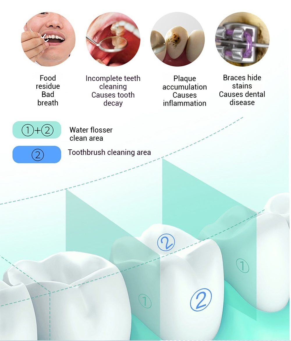 INSMART Electric Water Floss Teeth Cleaner Teeth Portable Cleaner ...
