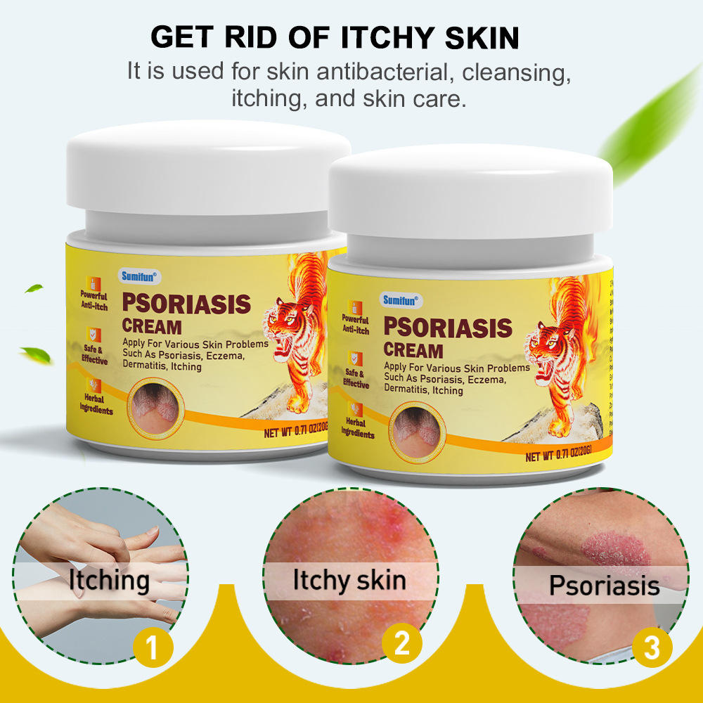 Psoriasis cream 20g for Erythema Ringworm Tinea Fungal bacterial Eczema ...