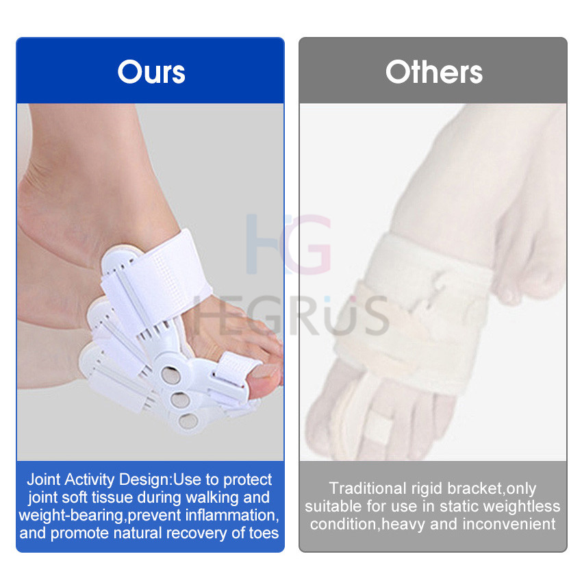 HEGRUS 1PCS Bunion Corrector Toe Corrector Big Toe Eversion Splint ...