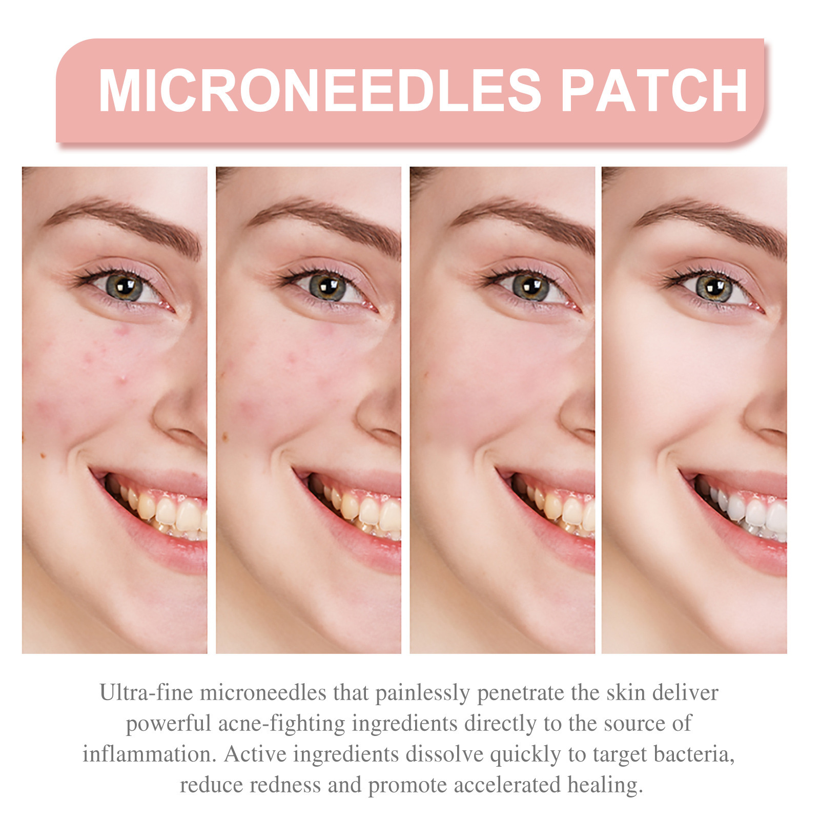 72pcs Pimple Patches for Face, Hydrocolloid Acne and Zit Patches ...