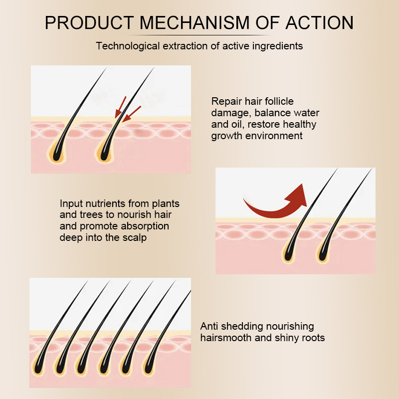 RAVINIA Hair growth spray 60ml Hair care Anti hair loss Fast hair ...