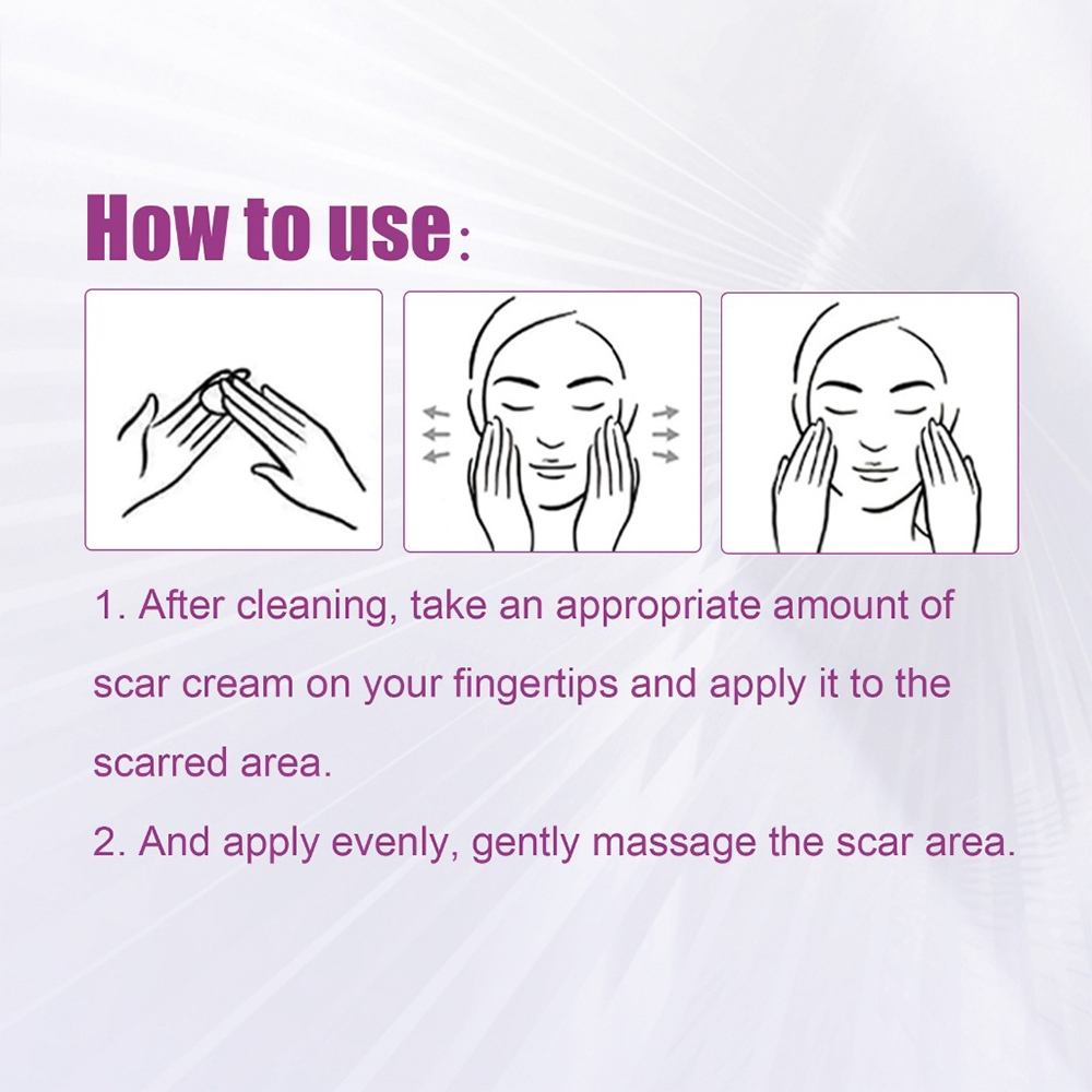 Ouhoe Scar Remover Cream Advanced Mild Operation Scar Gel Dermatic Scar ...