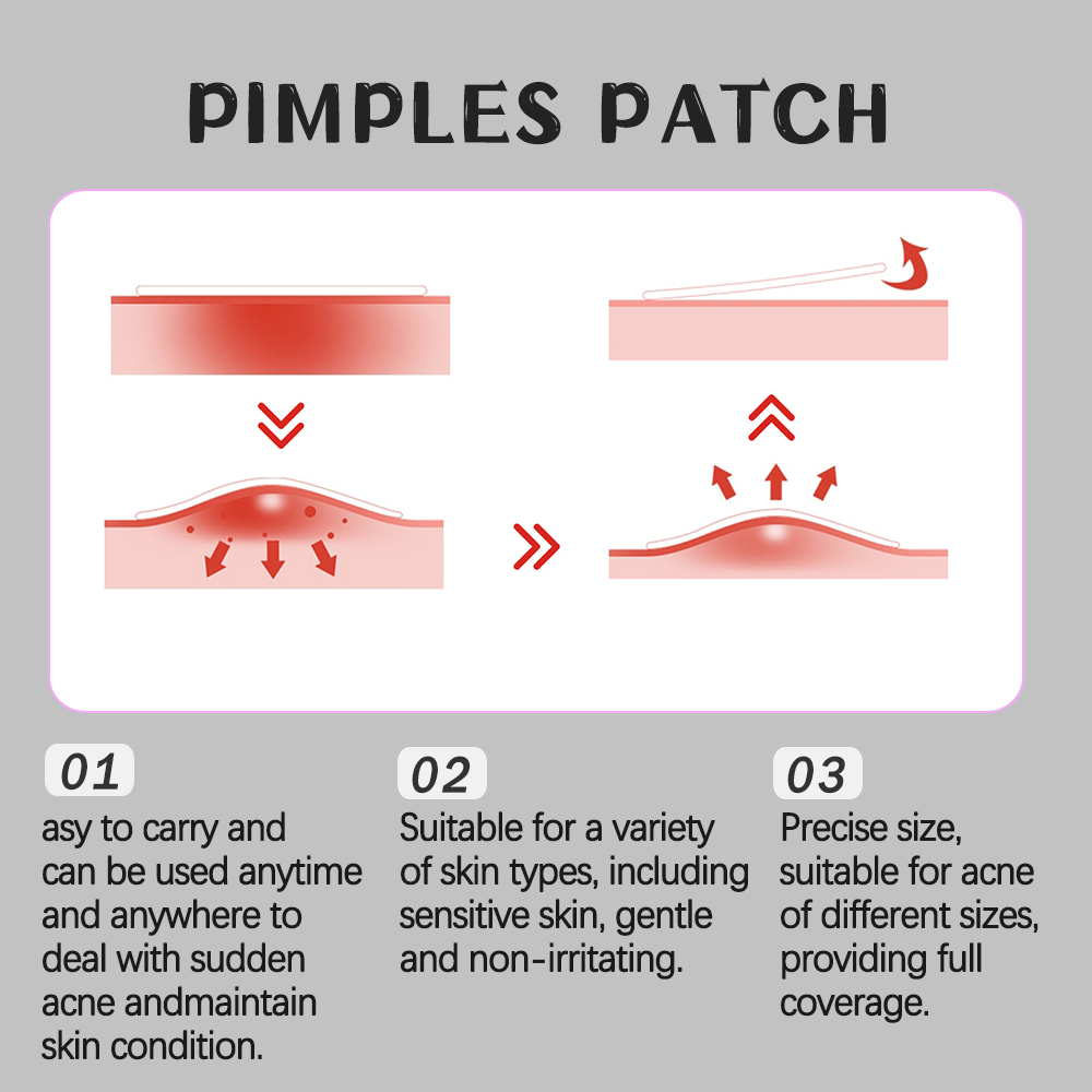 288PCS Pimple Patches for Face, Hydrocolloid Acne Patches for Covering ...