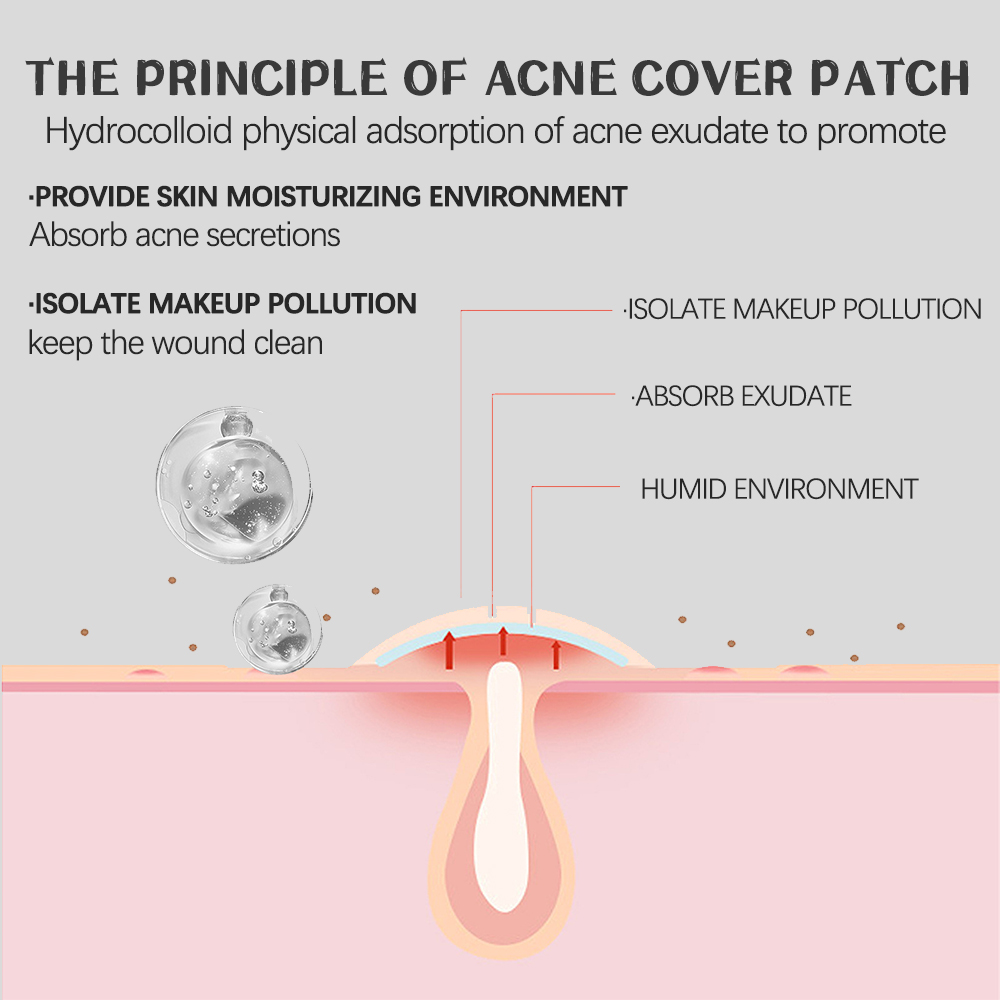 288PCS Pimple Patches for Face, Hydrocolloid Acne Patches for Covering ...
