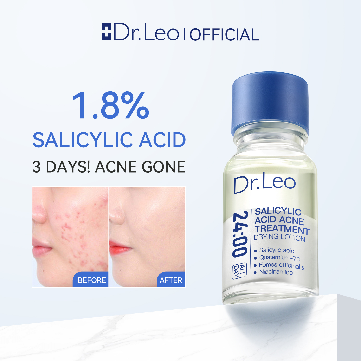 Dr.Leo Essence Salicylic Acid Anti-acne Serum Lighten Acne Scars Acne ...