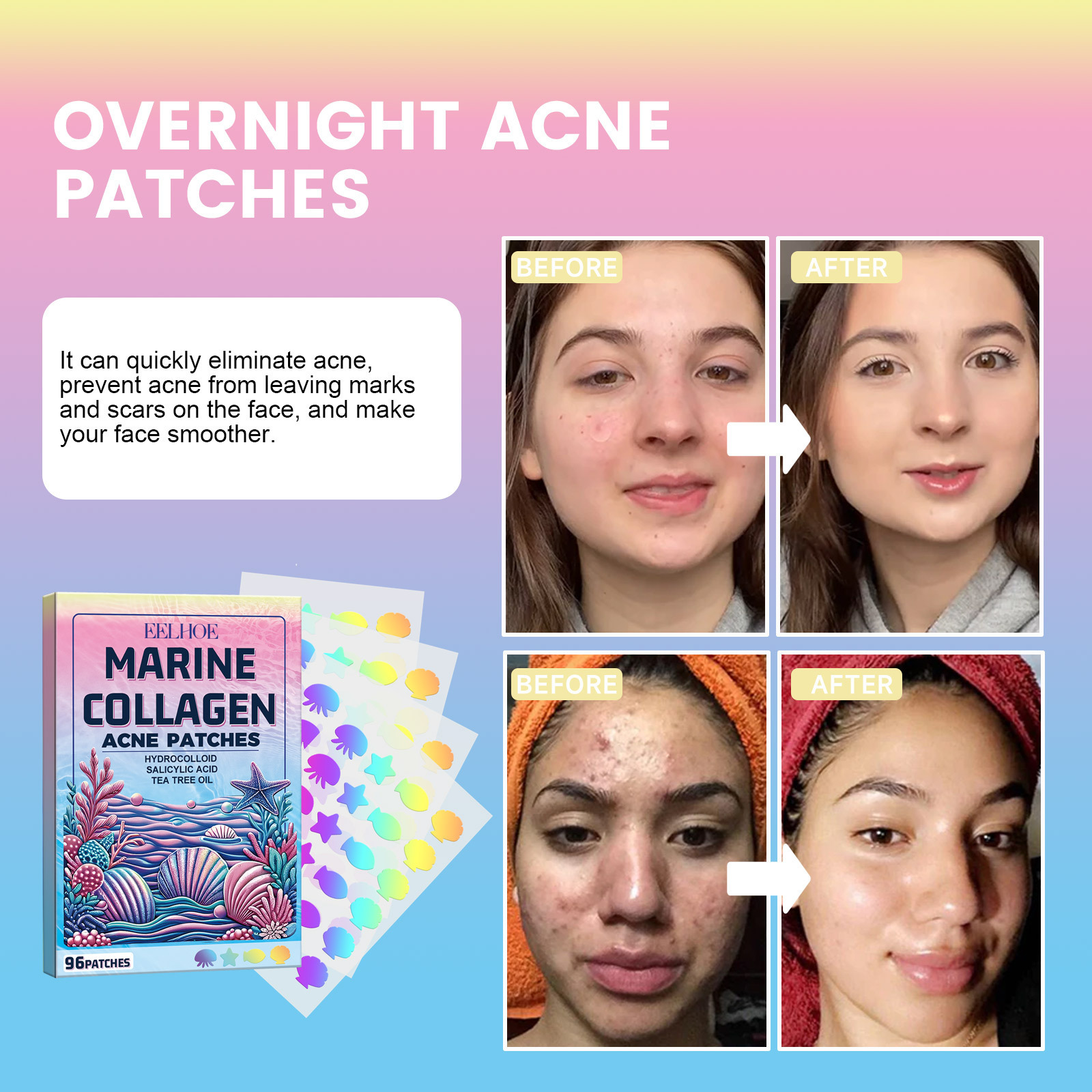 Cute Marine Collagen Patches for Acne, 96 Pieces Perfect for Spots and ...