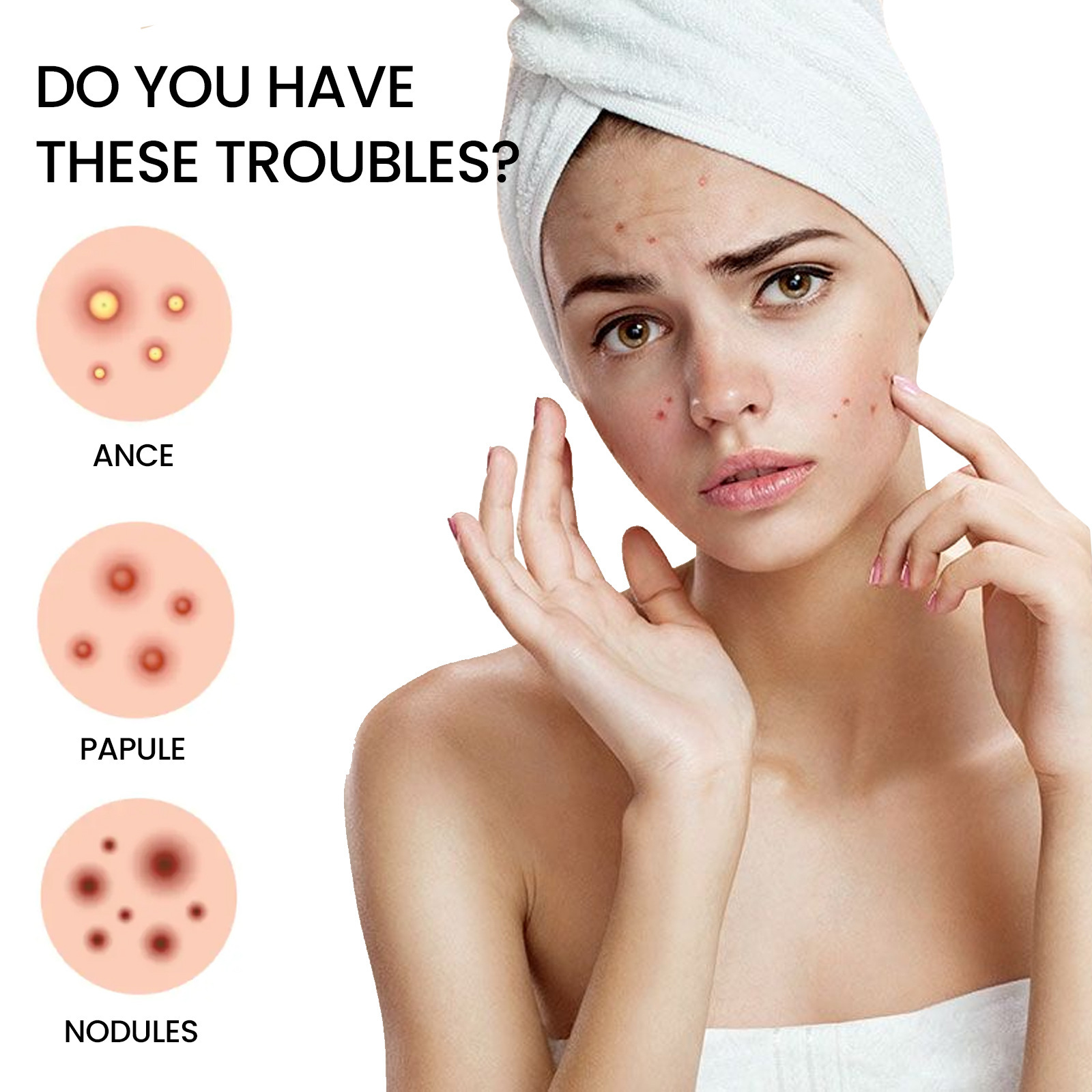 Hydrocolloid Acne Patches, 132 Stickers for Nose, Cheek, Chin ...
