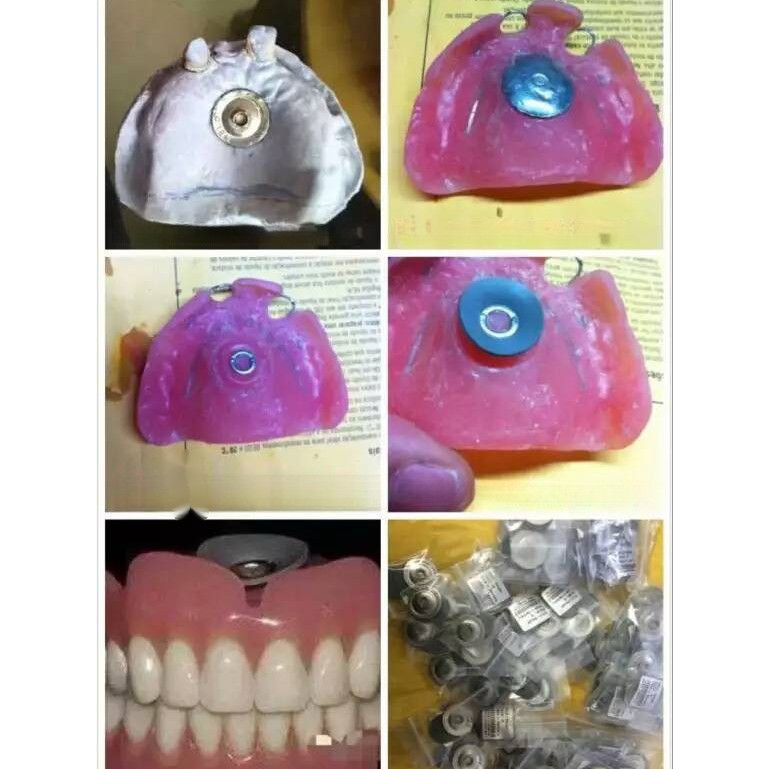 Dental Lab Dental Rubber Disc Sucker Denture Upper Plate Retention For ...