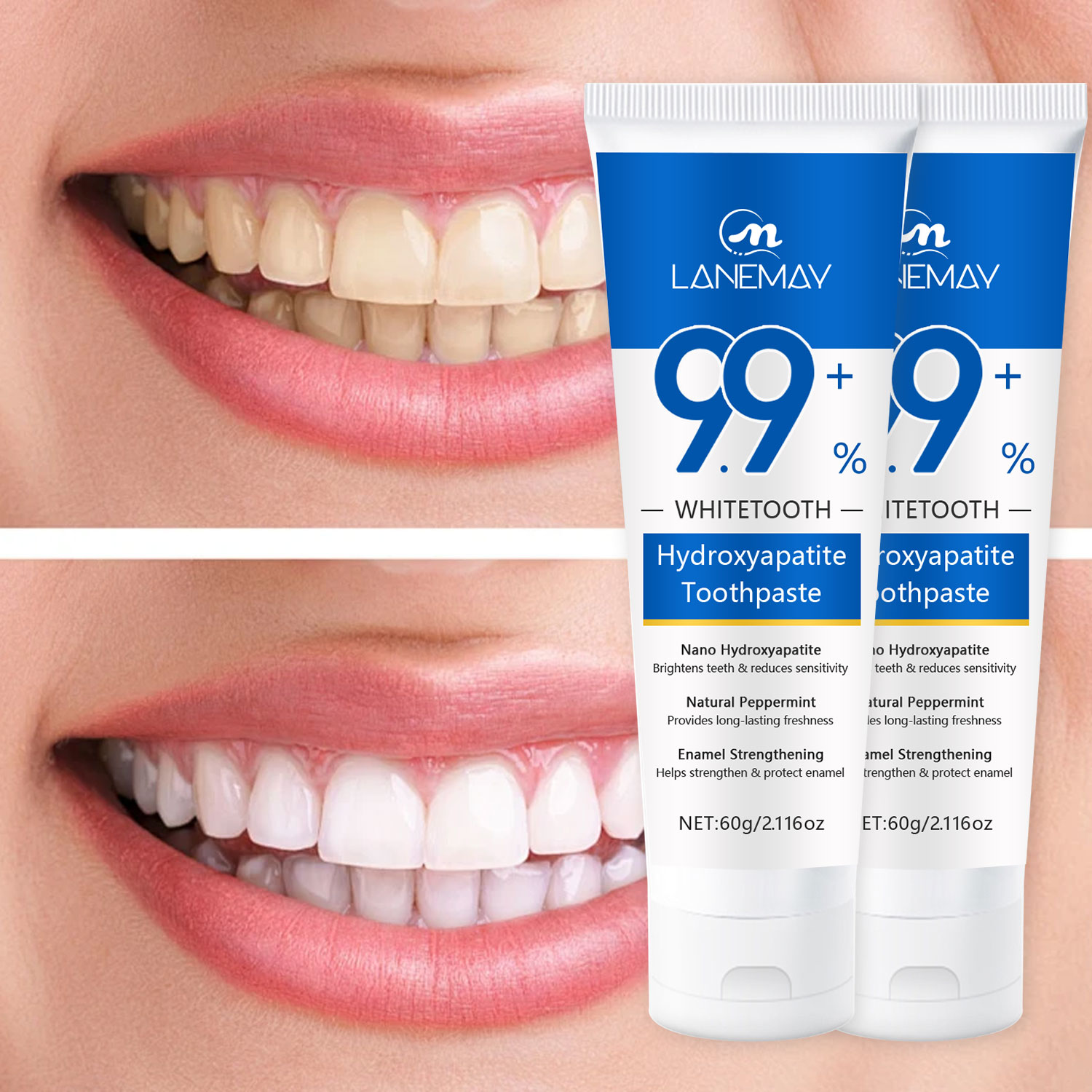 Nano Technology Hydroxyapatite Toothpaste - Brightens Teeth, Reduces ...