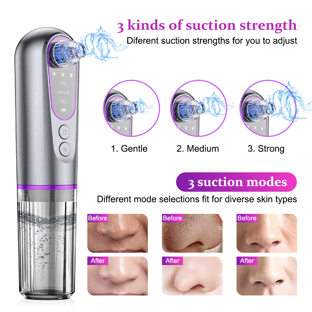 Small bubble blackhead suction device with three levels of adjustment ...