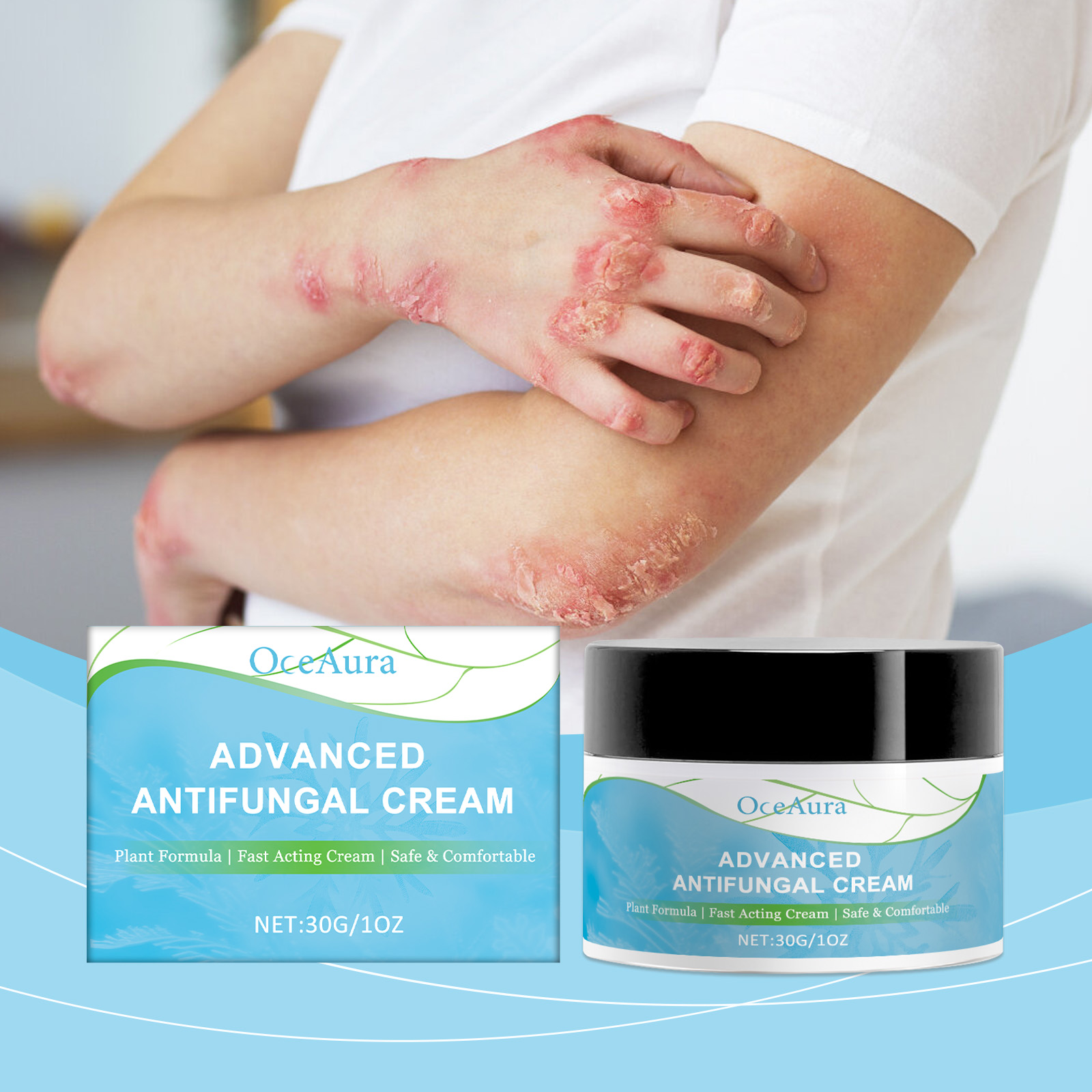 Anti Fungal Ringworm Fungisol Antifungal Psoriasis Antifungal Cream 30g ...