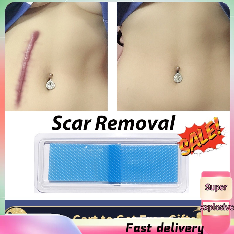 【TTLIFE】Removal Cesarean Section Hypertrophic Keloid Skin Scars Therapy Treatment Scar Away