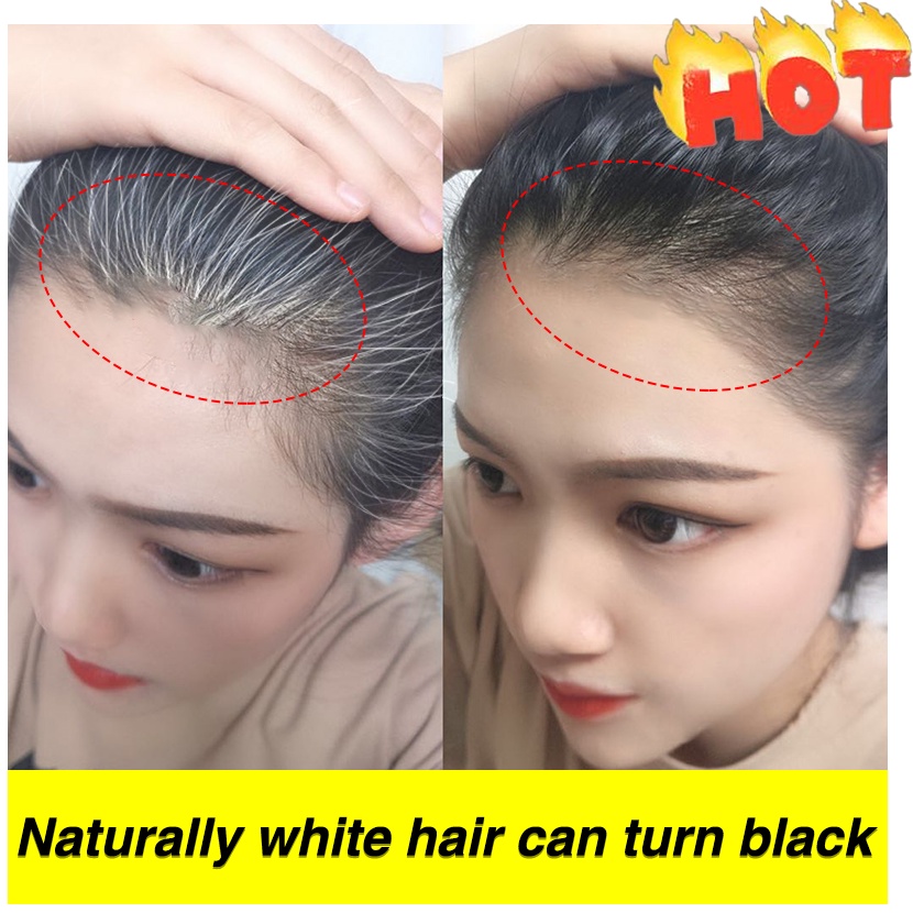 Black Hair Dyeing Spray Black Hair Shampoo Polygonum Multiflorum Serum