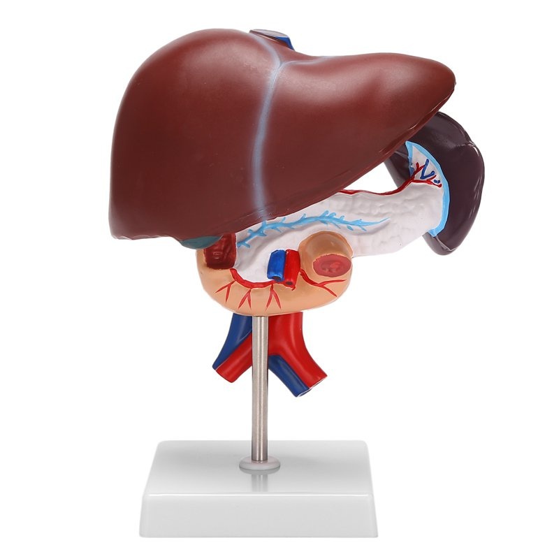 Human Liver Pathological Anatomical Model Liver Pancreas Duodenum ...