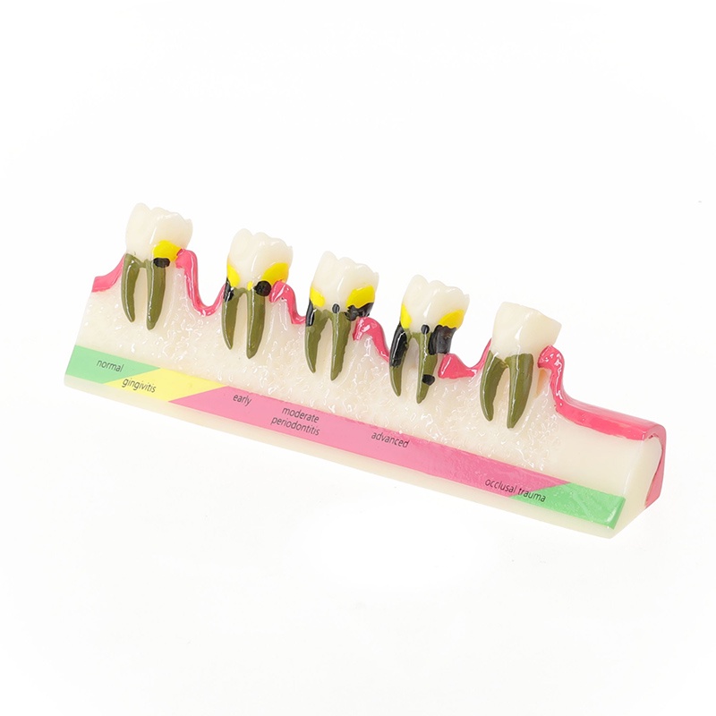 Dental Periodontal Model Tooth Study Teaching Model for School /Lab ...