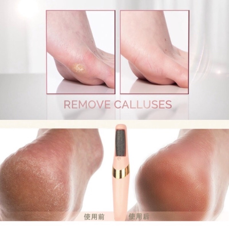 15Pcs Callus Shaver Callus Remover for Feet Heel Hard Skin Corn