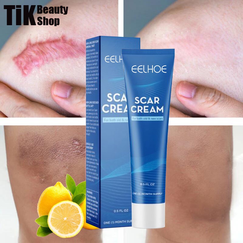 Effective 30ML Scar Cream Remover Acne Scar Remover Gel Serum Cream
