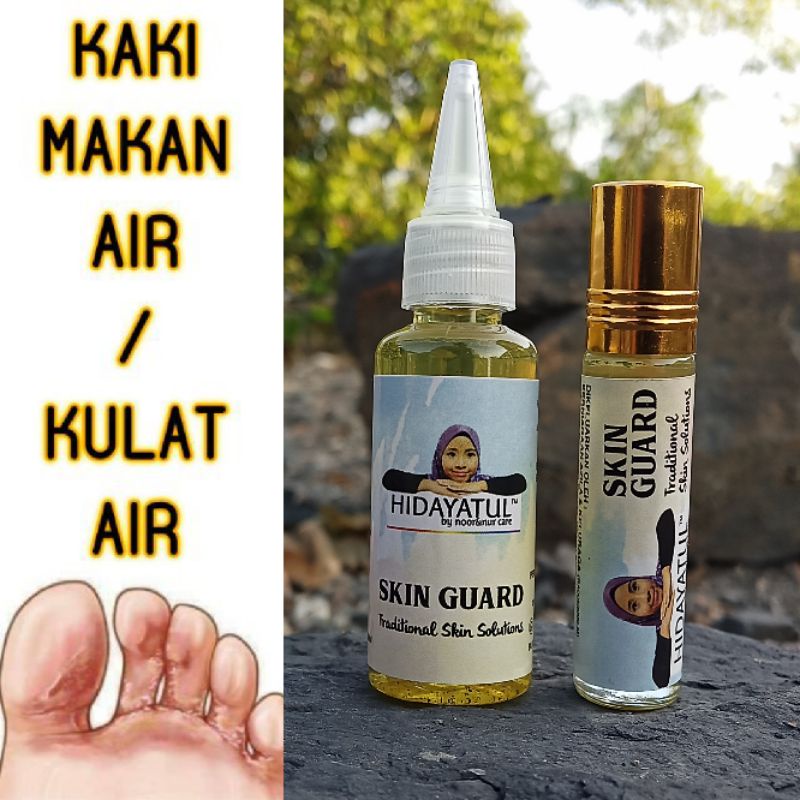 Minyak herba, untuk kaki makan air / kulat air / athlete foot | Shopee ...