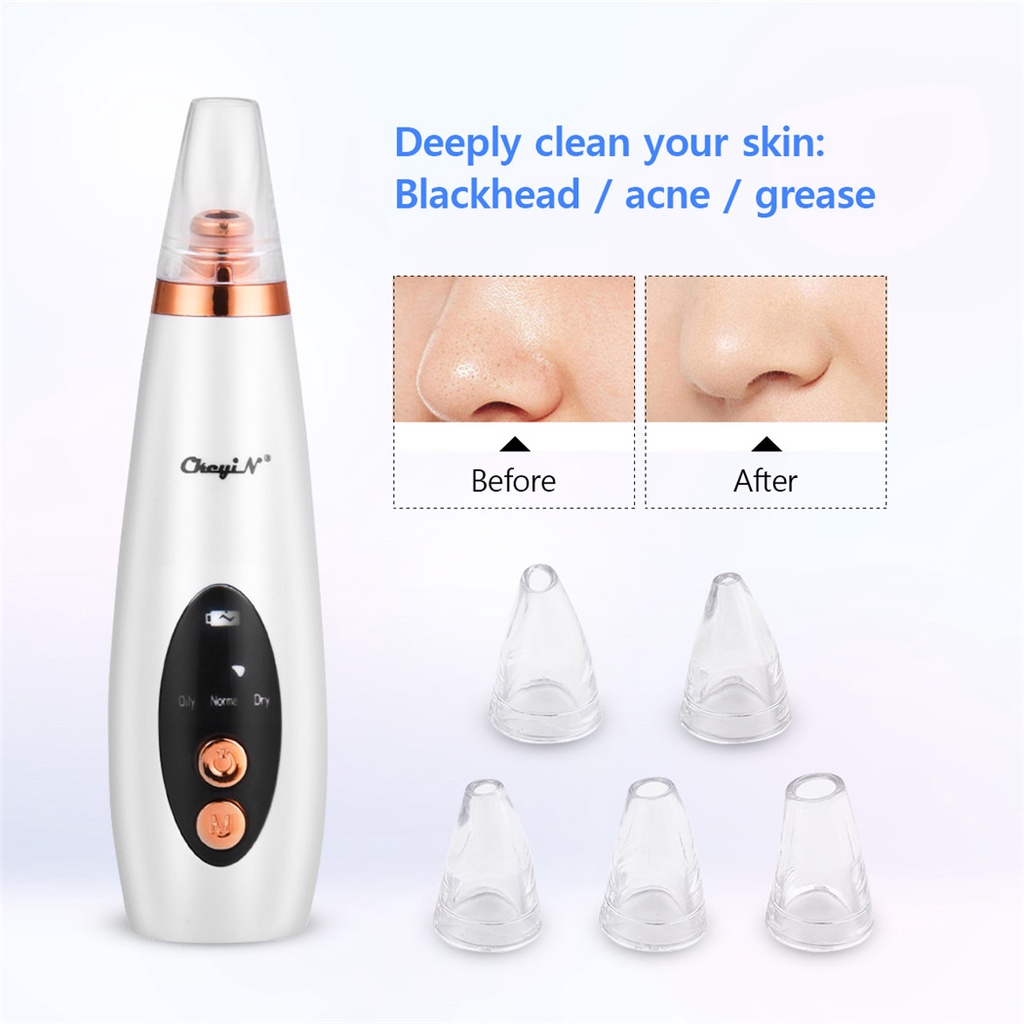 CkeyiN 6 Tips Electric Blackhead Remover Vacuum Suction Acne Comedo