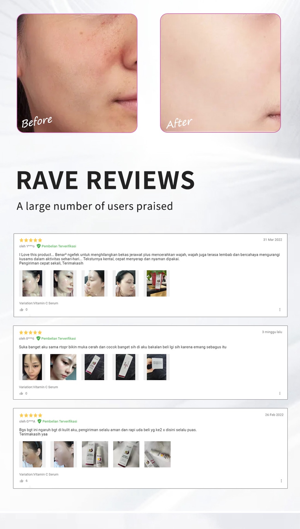 RtopR Vitamin C Whitening Moisturizing Serum Hyaluronic Acid ...