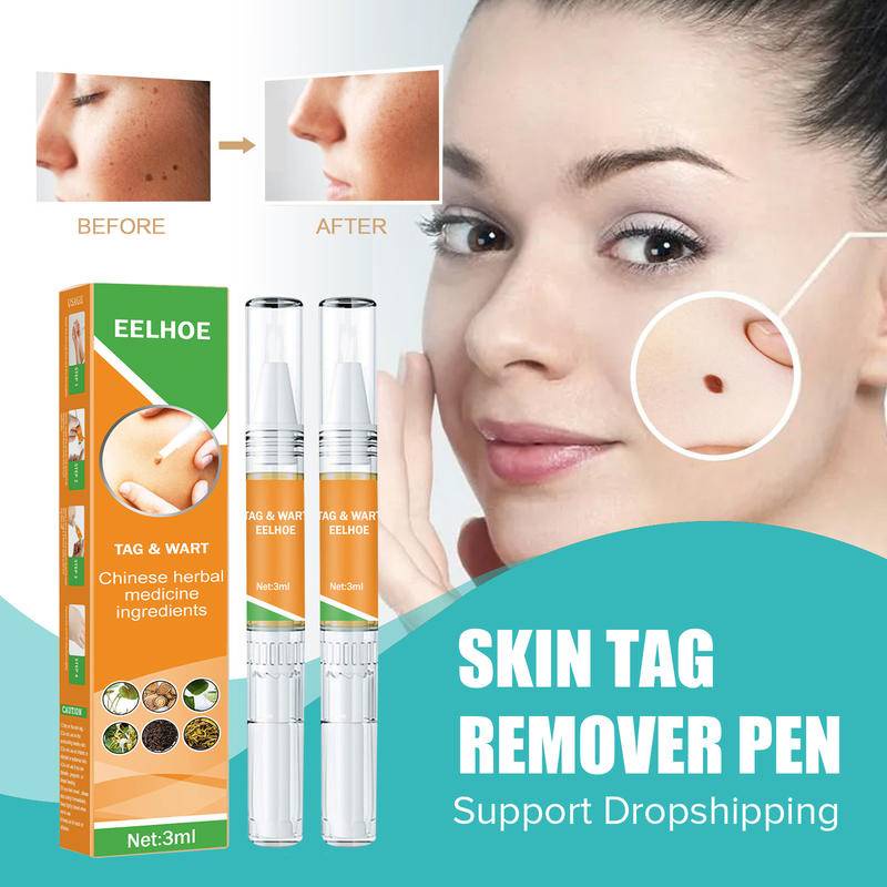 Wart Remover Pen Skin Tag Papillomas Moles Removal Liquid Point Mole ...