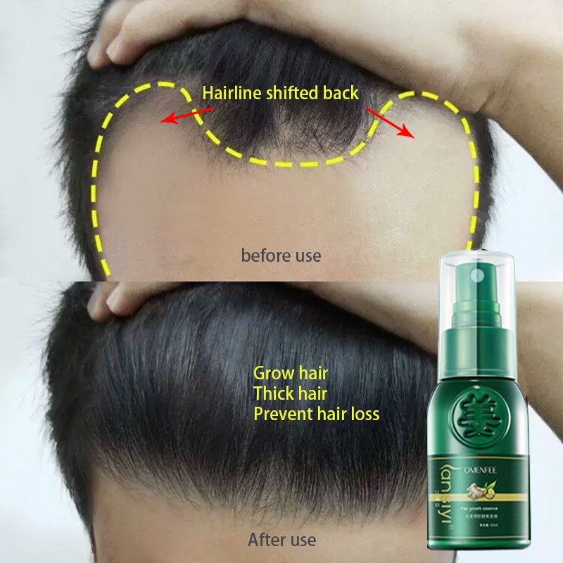 hair growth spray anti hair loss spray Nourishes hair roots Improves