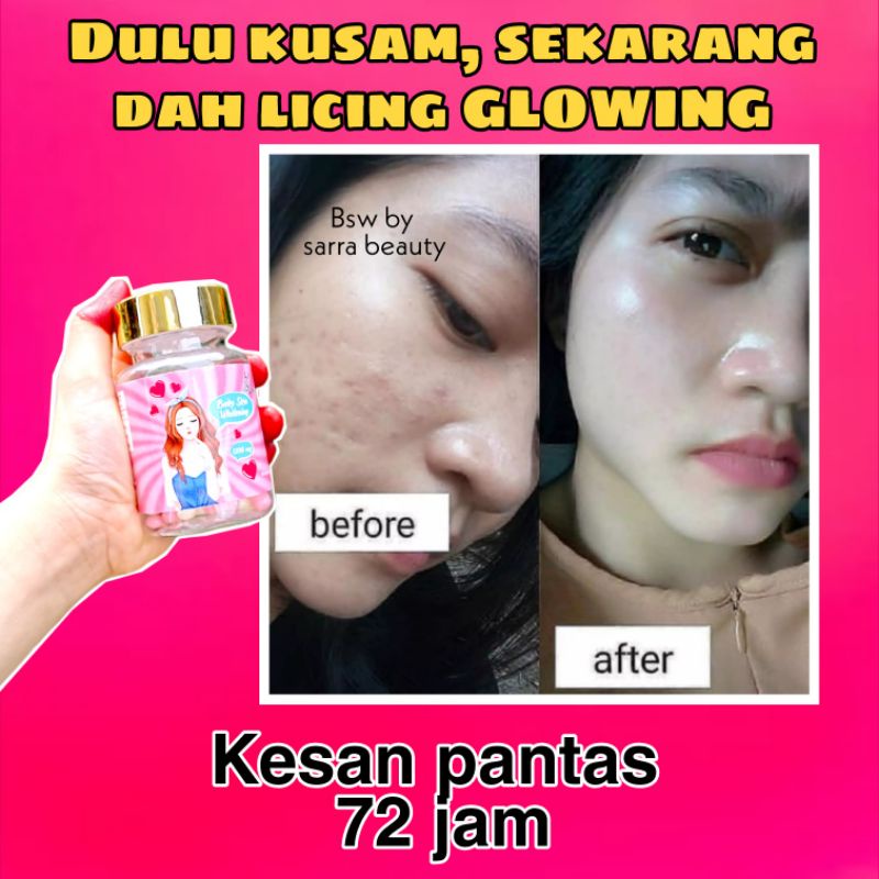 BABY SKIN WHITENING 💯 ORIGINAL 💯 +Free gift Shopee Malaysia