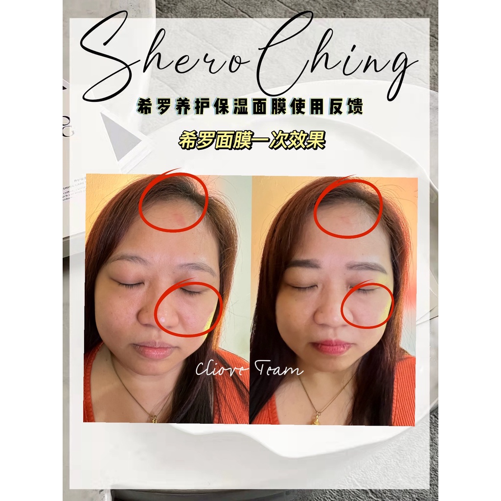 （READY STOCK) SHERO CHING 希罗养护保湿面膜 | Shopee Malaysia