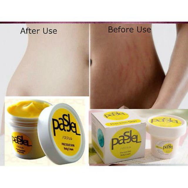 Krim Parut And Selulit Stretch Mark Cream Shopee Malaysia