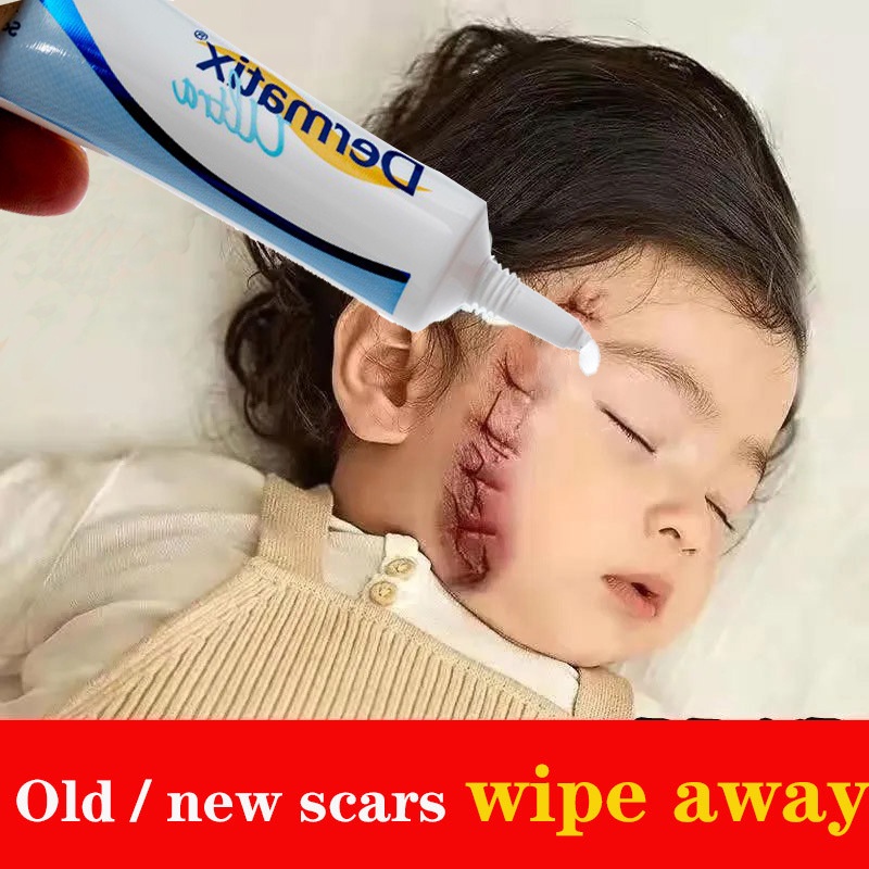 Dermatix Ultra Gel 15g Scar Reduction Cream Reduce Burns Surgical Scars