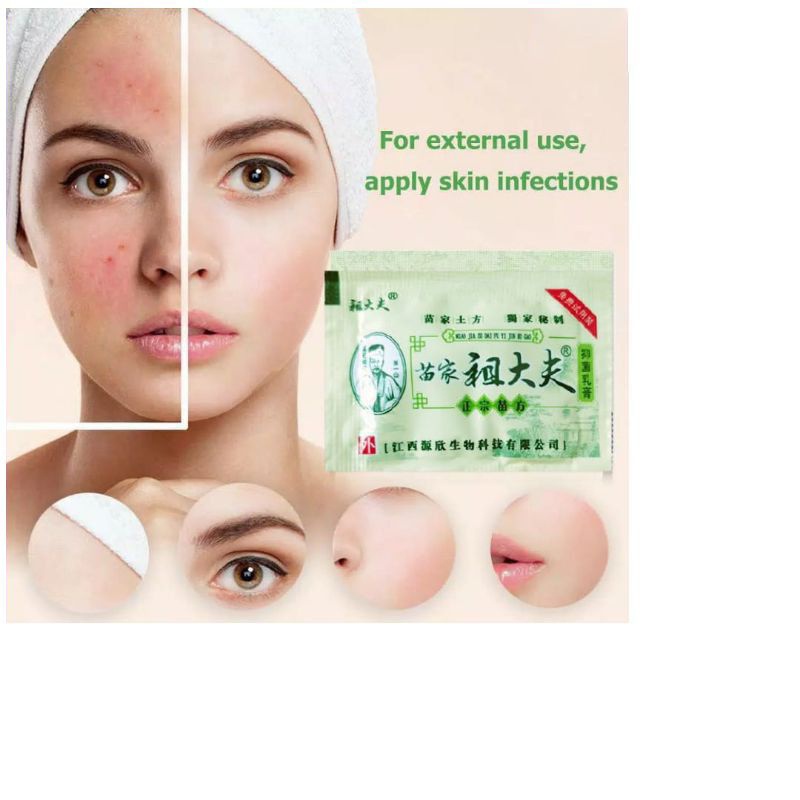 Zudaifu Sachet Mini Sachet 2gr Itchy Ointment Psoriasis Ointment