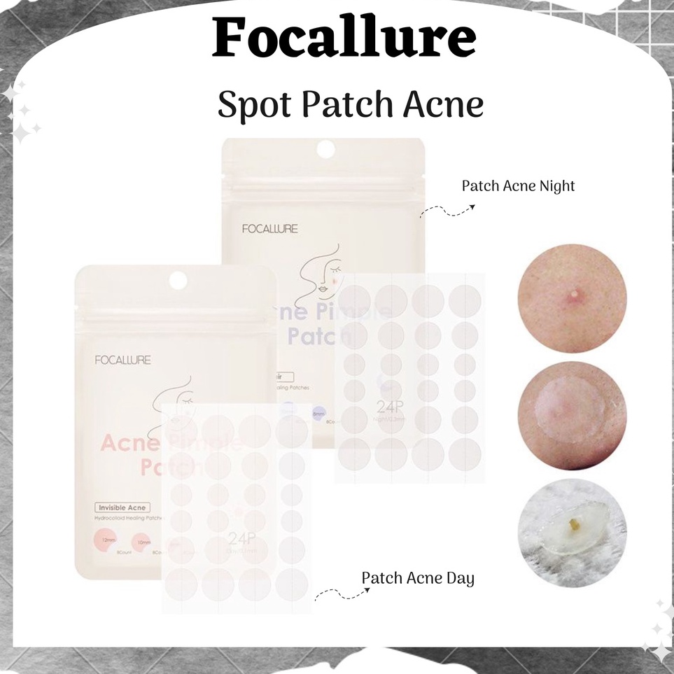 Focallure Spot Acne Patch Treatment Day Night Waterproof Smooth