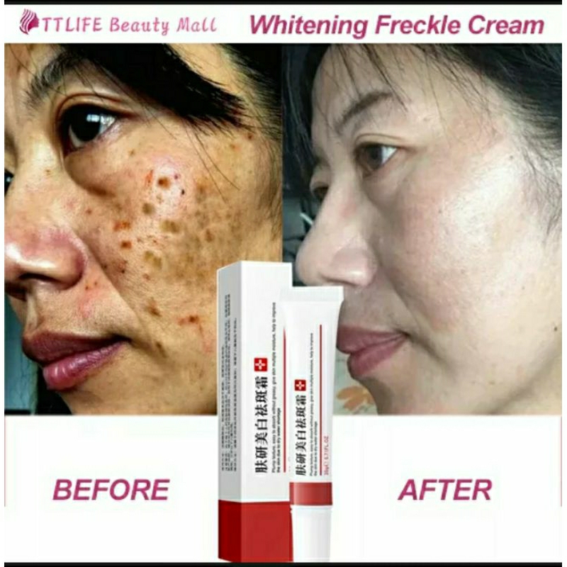 HITAM Removing Black Spots On The Face Facial Whitening Cream Smoothing