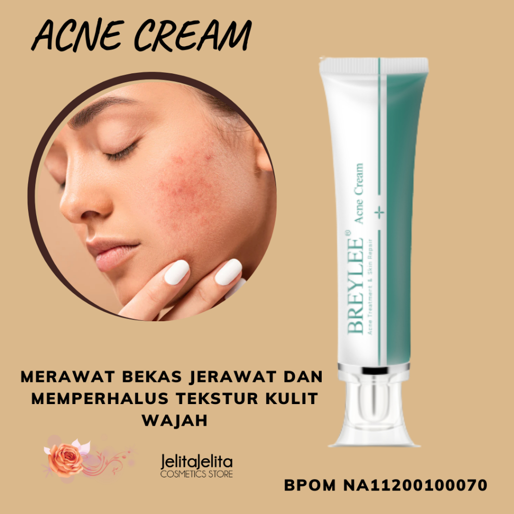 Acne Cream Breylee Acne Scar Removal Acne Scars And Stretchmarks G Shopee Malaysia