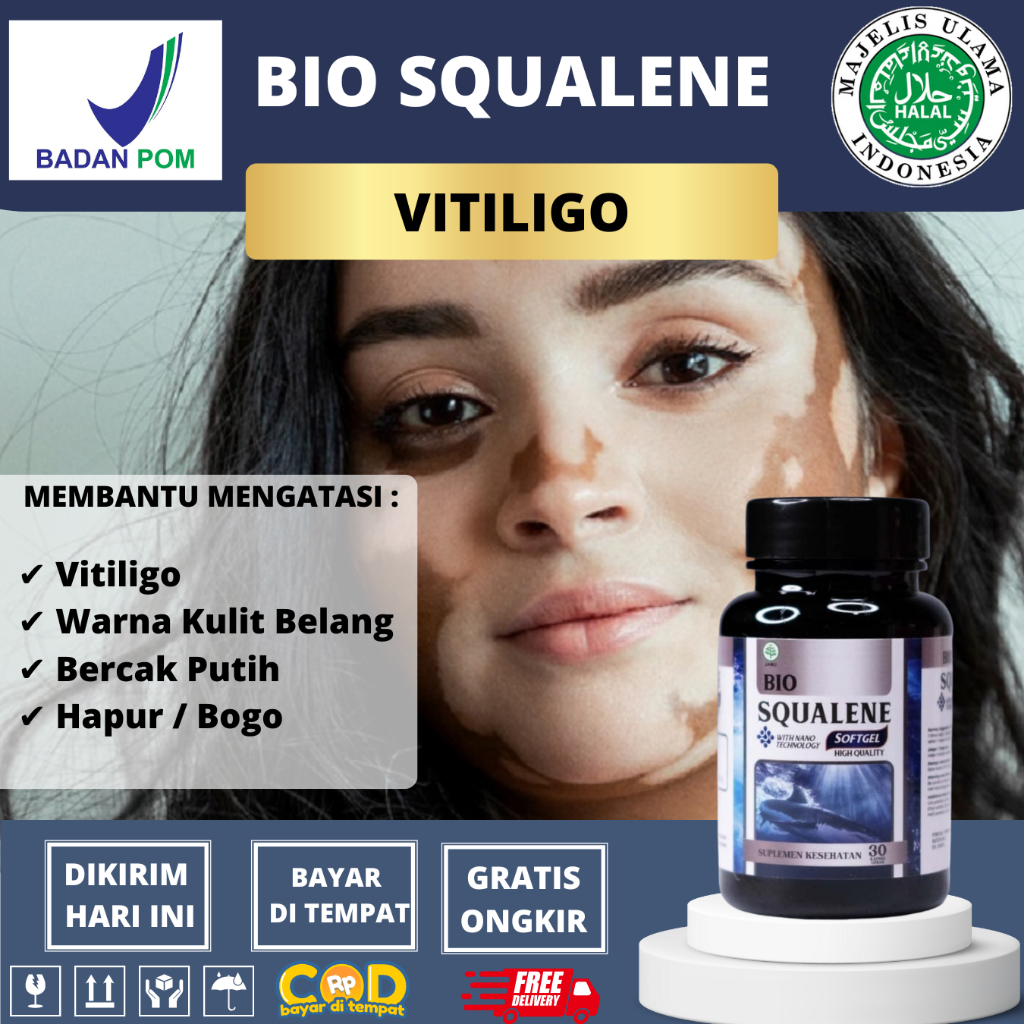 Vitiligo Medicine, panu, Prickly Sweat, antiBacterial panu Ointment