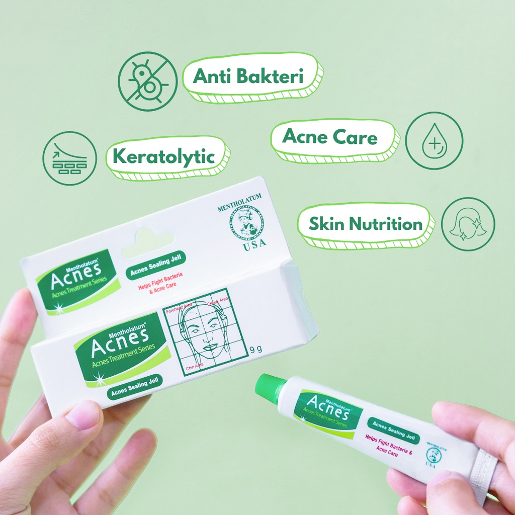 Acnes Sealing Gel/Acne Gel/Acne Gel/Acne Care Original Shopee Malaysia