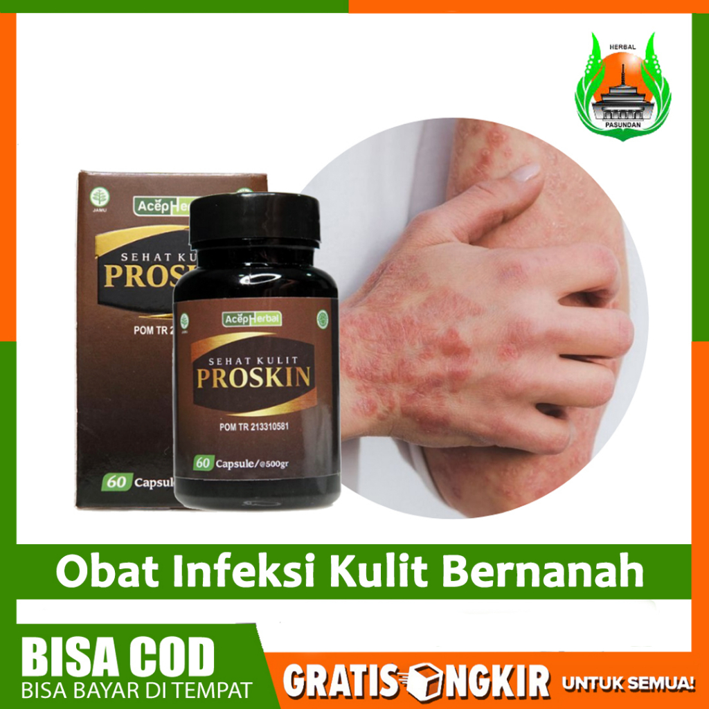 MERAH Medicine For Infection Of Skin With Itchy Red Rashes On The Skin