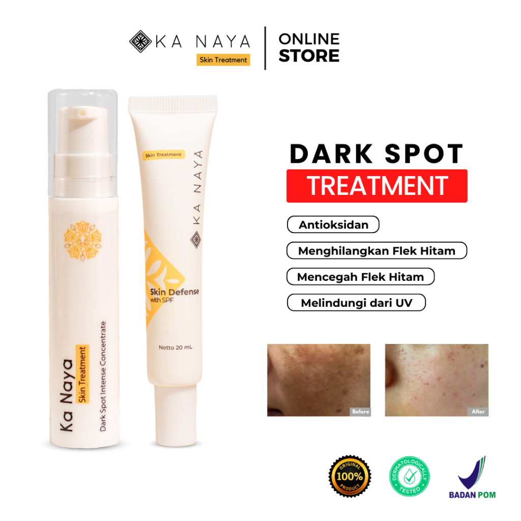 HITAM Ka Naya Dark Spot Package | Stubborn Spots Ointment | Black Spots ...