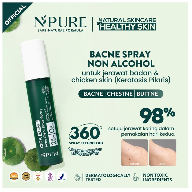 Npure Bacne Spray 50mL 100ORI Back & Body Acne/Chicken Skin/Keratosis